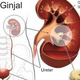 Illustration for article titled Obat Batu Ginjal Untuk Ibu Hamilem/em